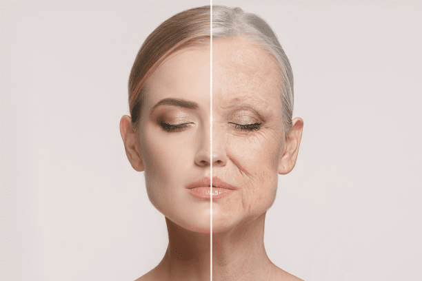 Wrinkles Treatment | Dr. Manisha Mareddy