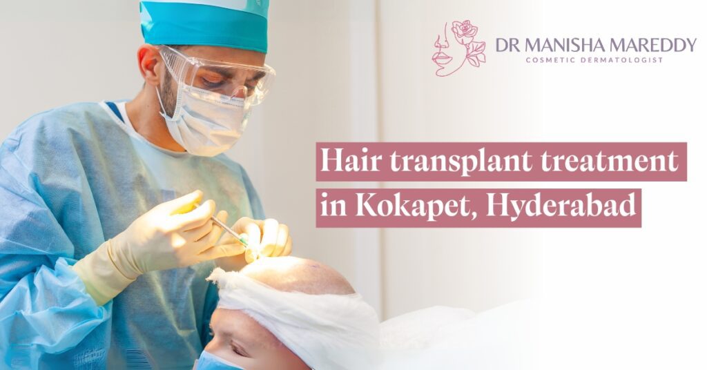 Hair Transplant Treatment in Kokapet