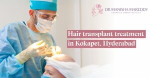 Hair Transplant Treatment in Kokapet