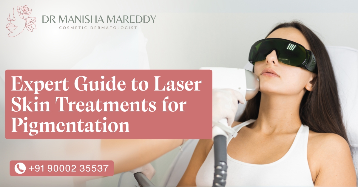 Expert Guide to Laser Skin Treatments for Pigmentation