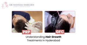 Difference between PRP and GFC hair treatments for hair growth in Hyderabad