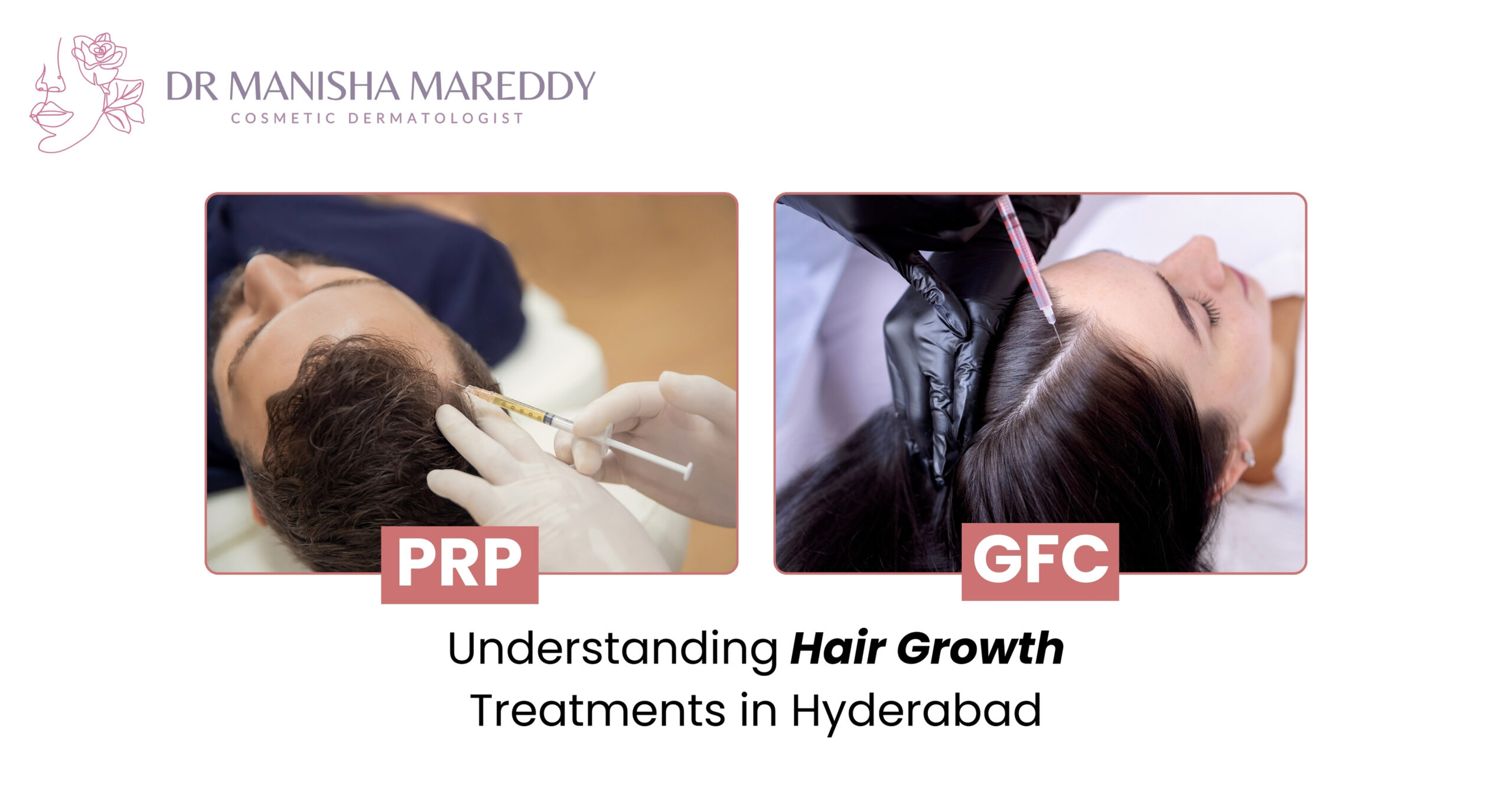 Difference between PRP and GFC hair treatments for hair growth in Hyderabad